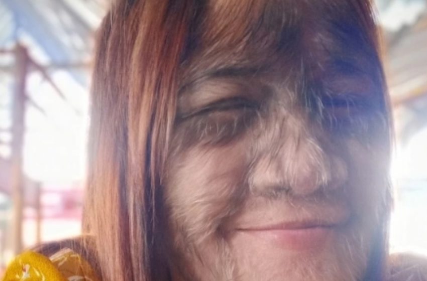  «Η Πιο Τριχωτή Κοπέλα του Κόσμου» Μεγάλωσε και Είναι Τρελά Ερωτευμένη!: Δείτε την Εκπληκτική Μεταμόρφωσή της!