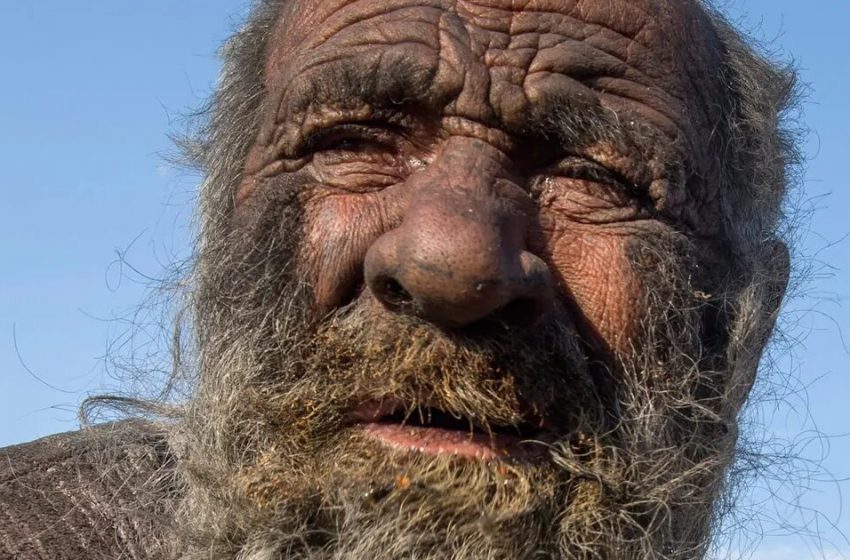  Έζησε 60 Χρόνια Χωρίς να Κάνει Μπάνιο!: Η Εμφάνισή Του Θα Σας Αφήσει Άφωνους!